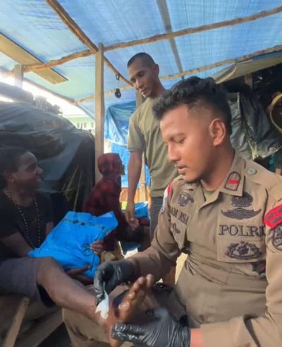 Peduli Kesehatan, Personil Ops Damai Cartenz 2025 Beri Pengobatan kepada Anak Yang Terluka di Sugapa Intan Jaya