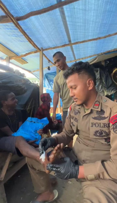 Peduli Kesehatan, Personil Ops Damai Cartenz 2025 Beri Pengobatan kepada Anak Yang Terluka di Sugapa Intan Jaya