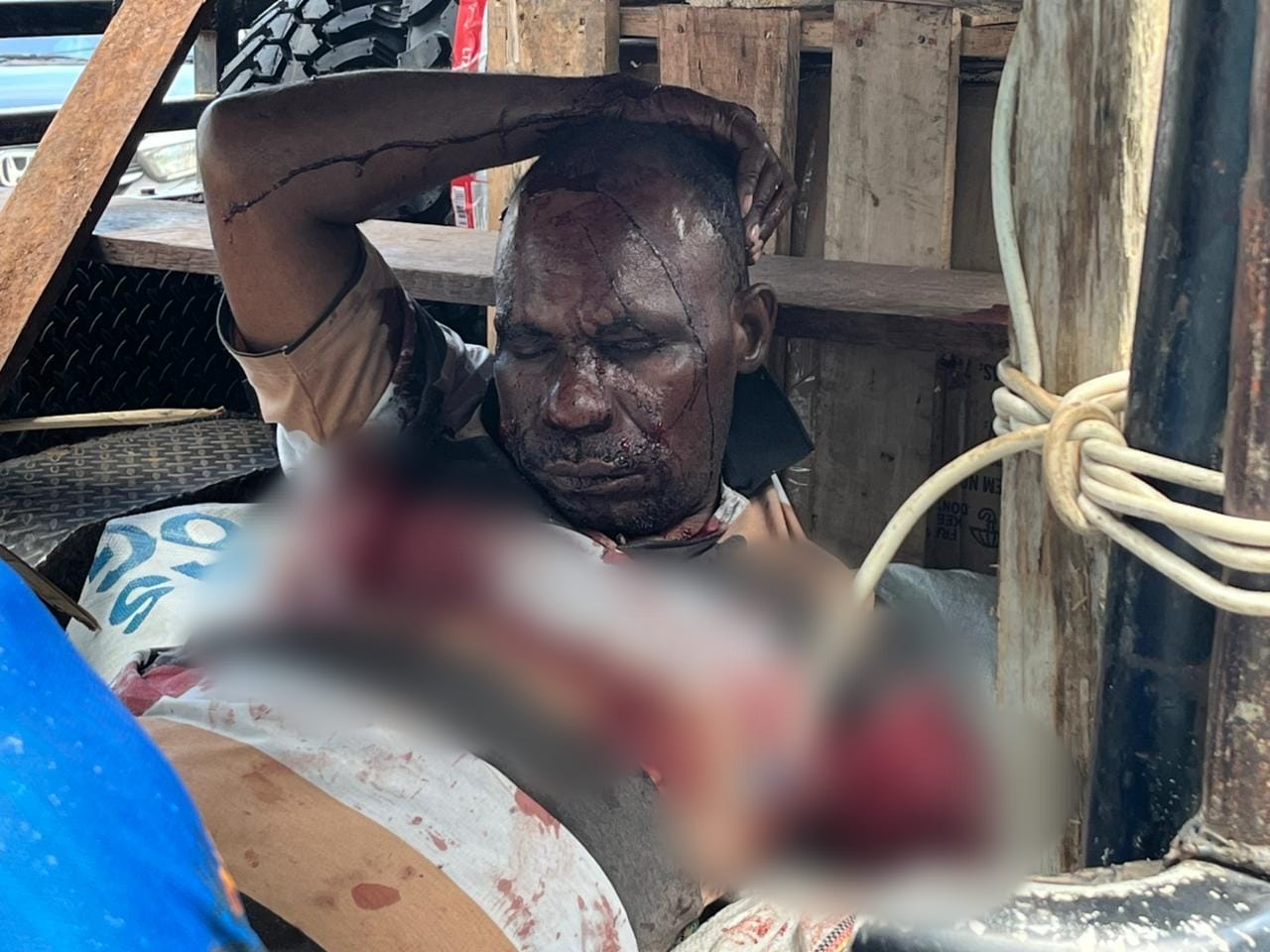 KKB Diduga Serang Warga Sipil di Nabire Papua Tengah, 1 Tewas dan 4 Luka