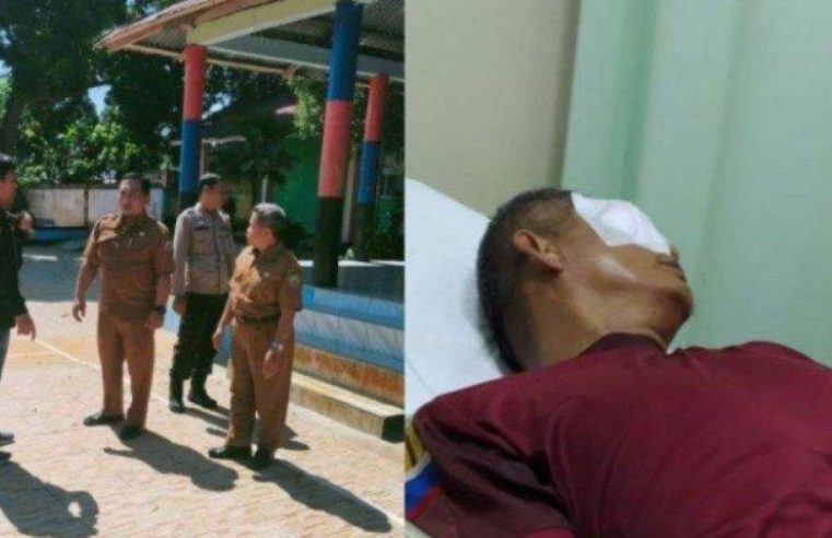 Buru Orang Tua Siswa Yang Katapel Mata Guru di Bengkulu, Polisi Bentuk Tim Khusus